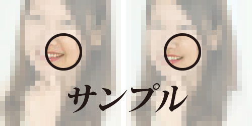 誰でも若肌!ほうれい線消します お見合い写真、プロフィール写真、インスタ映えなどに