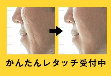 整形級も自然も!写真のレタッチをします 肌補正、レタッチ、不要な写り込みの削除、簡単な合成など