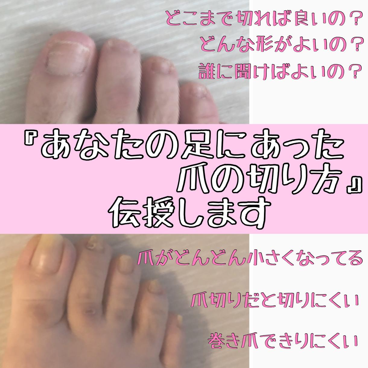 あなたの足に合った爪の切り方を伝授します 爪の切り方って一人1人違うって知ってましたか ヘアケア ネイルの相談 ココナラ あなたの足に合った爪の切り方を伝授します 爪の切り方って一人1人違うって知ってましたか ヘアケア ネイルの相談 ココナラ