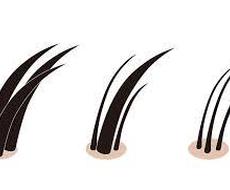 ハゲない髪の洗い方を伝授します 抜け毛で悩んでいた自分が実際に６年間、毎日続けてやった洗髪法