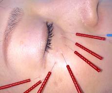 ほうれい線 フェイスライン 目の下の弛み 小じわ 乾燥肌 本当に効果がでる方法とは スキンケアの相談 ココナラ