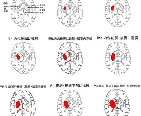 医療者向けの資料用イラストを作成致します 発表 論文資料など細かな指示に対応したイラストを作成します イラスト作成 ココナラ