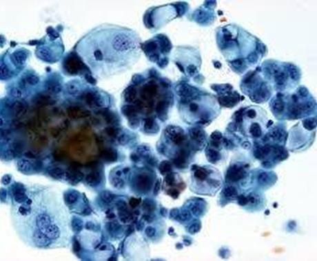 細胞検査士の資格勉強のコツを教えます 細胞検査士の勉強法 魅力などお答えします 資格取得の相談 ココナラ