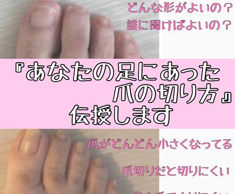 あなたの足に合った爪の切り方を伝授します 爪の切り方って一人1人違うって知ってましたか メイク ネイル 各種ケアの相談 ココナラ