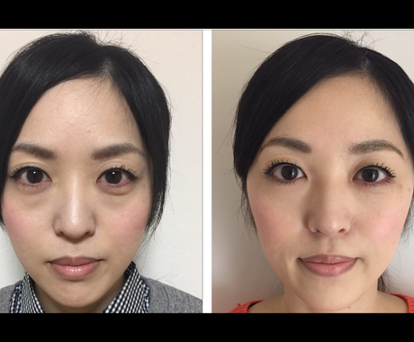 顔ヨガで若返り 素敵なモテ笑顔にさせてみます 婚活 結婚式 就活 アンチエイジングなどにおすすめ体験60分 その他 美容 ファッション 健康 ココナラ
