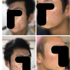 現役美容看護師S