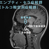 限界看護師の本音相談室