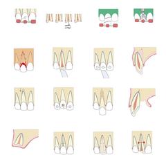 歯科専門書籍用イラスト