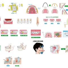 患者説明用イラスト