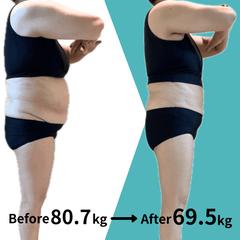 ダイエット成功事例｜ビフォーアフター③