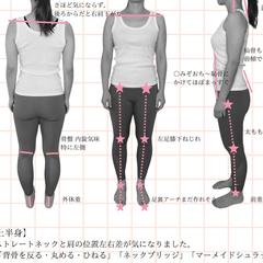 骨格分析の例