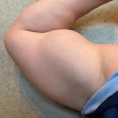 私の腕です(笑)