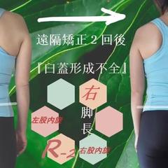 【遠隔】究極の骨盤矯正