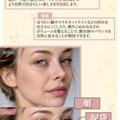 美容クリニック広告画像