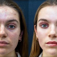 人物レタッチ：自然な質感を残した美肌補正・目元印象アップ