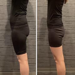 美容骨盤矯正　ダイエット