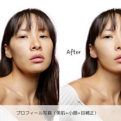 シミ・そばかす除去レタッチ