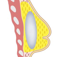 スライド用挿絵