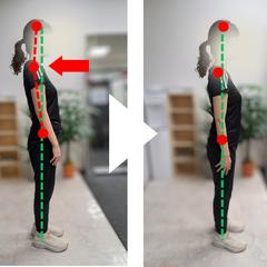 姿勢改善の例（20代女性）