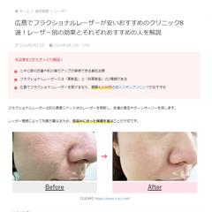 美容メディア「BinanBijo」様にて記事作成を行いました