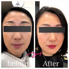 顔分析メイク　ビフォアアフター