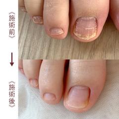 ネイルケア
