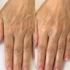 手荒れや手肌のシワが気になるお客様のハンドケア