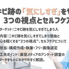 ニキビ跡の悩みに寄り添う解説記事