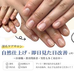爪悩み専門店様　バナー